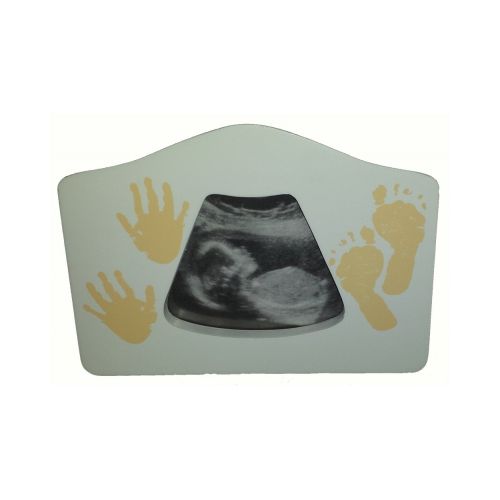 3D Erinnerungen - Fotorahmen für Ultraschallbild - 2